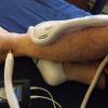 MicroLight Smart Laser | Single Probe - Image 2