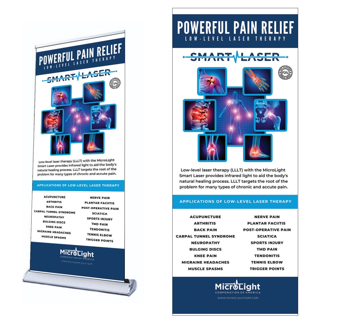 MicroLight Smart Laser | Pull Up Banner - Powerful Pain Relief - Microlight  Corporation